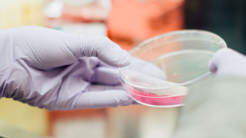 ESDHD Research